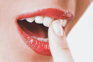  Làm thế nào để tăng cường răng lỏng lẻo