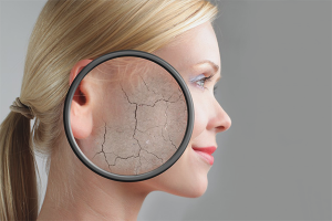  Bagaimana untuk menghilangkan kulit mengelupas di muka