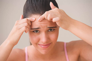  Hoe zich te ontdoen van interne acne