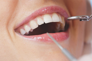 Bagaimana untuk menghilangkan penyakit periodontal