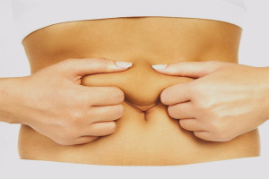  Cómo tensar la piel del abdomen después del parto.