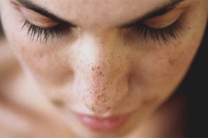  Cómo eliminar manchas de la edad en la cara.