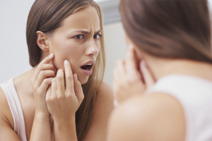  Zašto se akne pojavljuju na licu?