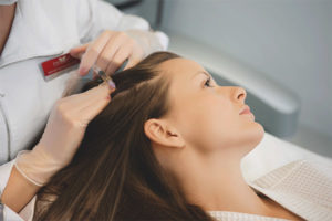  Hair mesotherapy
