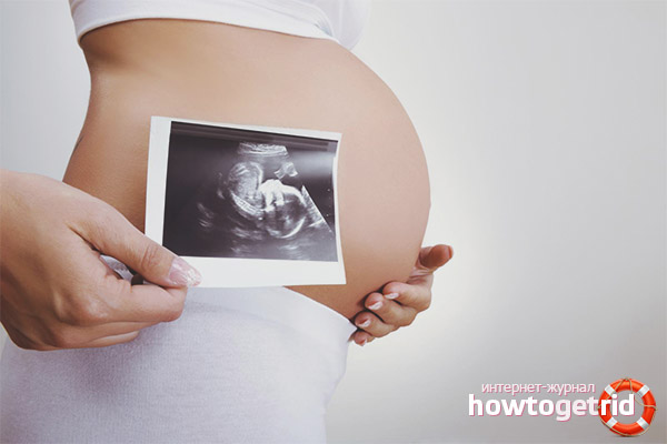  Kajian saringan bagi pelbagai kehamilan
