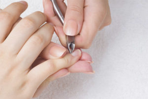  Kako ukloniti neravnine na prstima